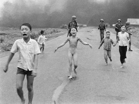 Seorang anak berusia 9 tahun yang terbakar parah di tengahnya: "Gadis Napalm.